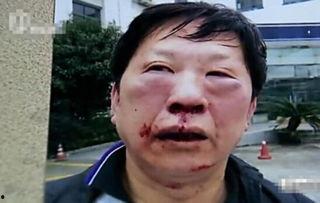 新闻爆料殴打老人,殴打老人事件引发社会关注